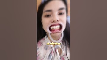 Bọc Răng Sứ Ngay Cả Khi Răng Đã Đều Và Đẹp | Làm Răng Sứ Khi Răng Đẹp | Răng Sứ Thẩm Mỹ #rangsu