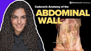 Anatomy of the Abdominal Wall | Which artery does this artery anastomose with? | Med School Bootcamp Highly Vascular Ining Of The Abdominal Cavity