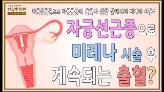 자궁선근증으로 출혈이 심해서 미레나 시술을 받은 후에도, 출혈이 계속되고 증상이 더 심해지는 이유는?