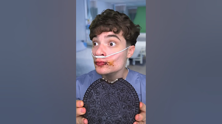 😲I Got Diabetes... (Giant Chocolates🍭🧐 ASMR) #challenge