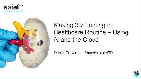 How AI is Transforming How We Create Patient-specific, 3D Printed Models for Pre-operative Planning