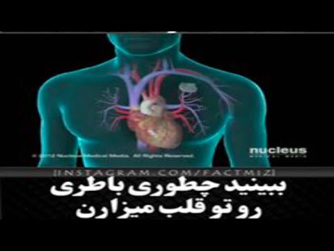 ببینید چطوری باطری رو توی قلب کار میگذارند و چرا
