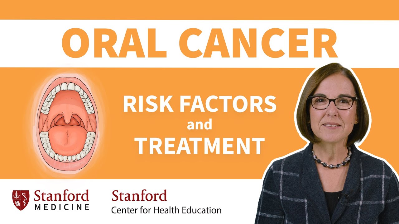 Oral Cancer: Prevention and treatment options from a medical oncologist | Stanford