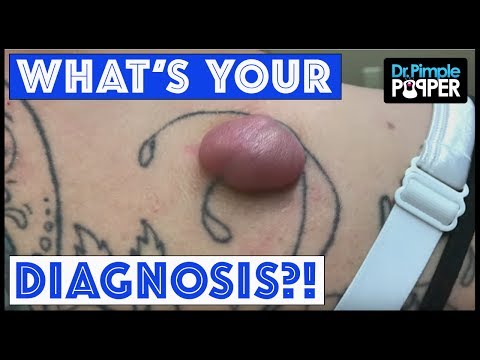 Popaholics: What Is Your Diagnosis!?