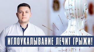 Иглоукалывание лечит грыжи! Подробно об иглорефлексотерапии.