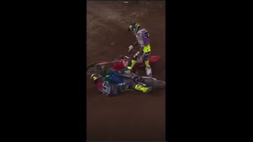 Broken collar bone #haidendeegan #bike #crash 