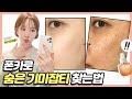 꼭 해보세요! 숨어있는 기미잡티 현실피부 되기 전에! 😨 탑티어 항산화앰플 브이앤에이 앰플 2주후기!