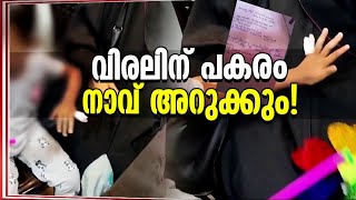 വിരലിന് പകരം നാവിന് ഓപ്പറേഷൻ; ചികിത്സാപ്പിഴവിൽ ആര്‌ മറുപടി പറയും? | Kozhikode