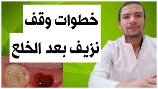 4 خطوات  لوقف النزيف بعد خلع الاسنان بدون الحاجه لمراجعه الطبيب