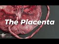 Let’s Look at a Real Placenta