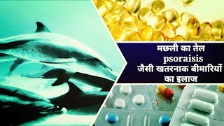 psoriasis treatment/मछली का तेल सोरायसिस जैसी घातक बीमारियों का इलाज