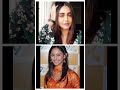 #trendingshorts #plasticsurgery #bhojpuri #krystledsouza