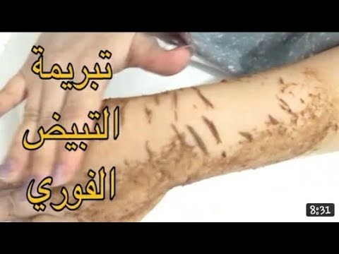 تبييض البشرة للرجال في أسرع وقت مع نتائج مضمونة. 