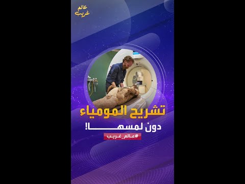 وجد العلماء طريقة لدراسة المومياوات دون خلع القماش الذي يغطيها للمحافظة عليها فما هي هذه الطريقة