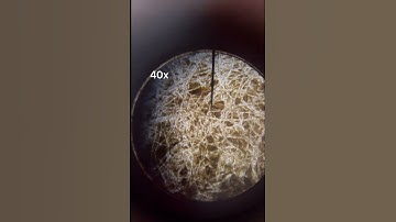 Microscopic Look At Mushroom Spores