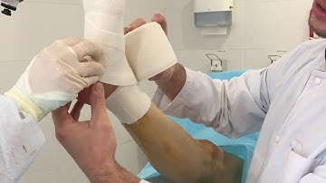Как правильно бинтовать ноги