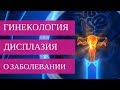 ДИСПЛАЗИЯ ШЕЙКИ МАТКИ - о заболевании | Добрый Прогноз