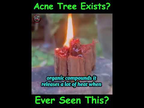 🌳 Acne Tree
