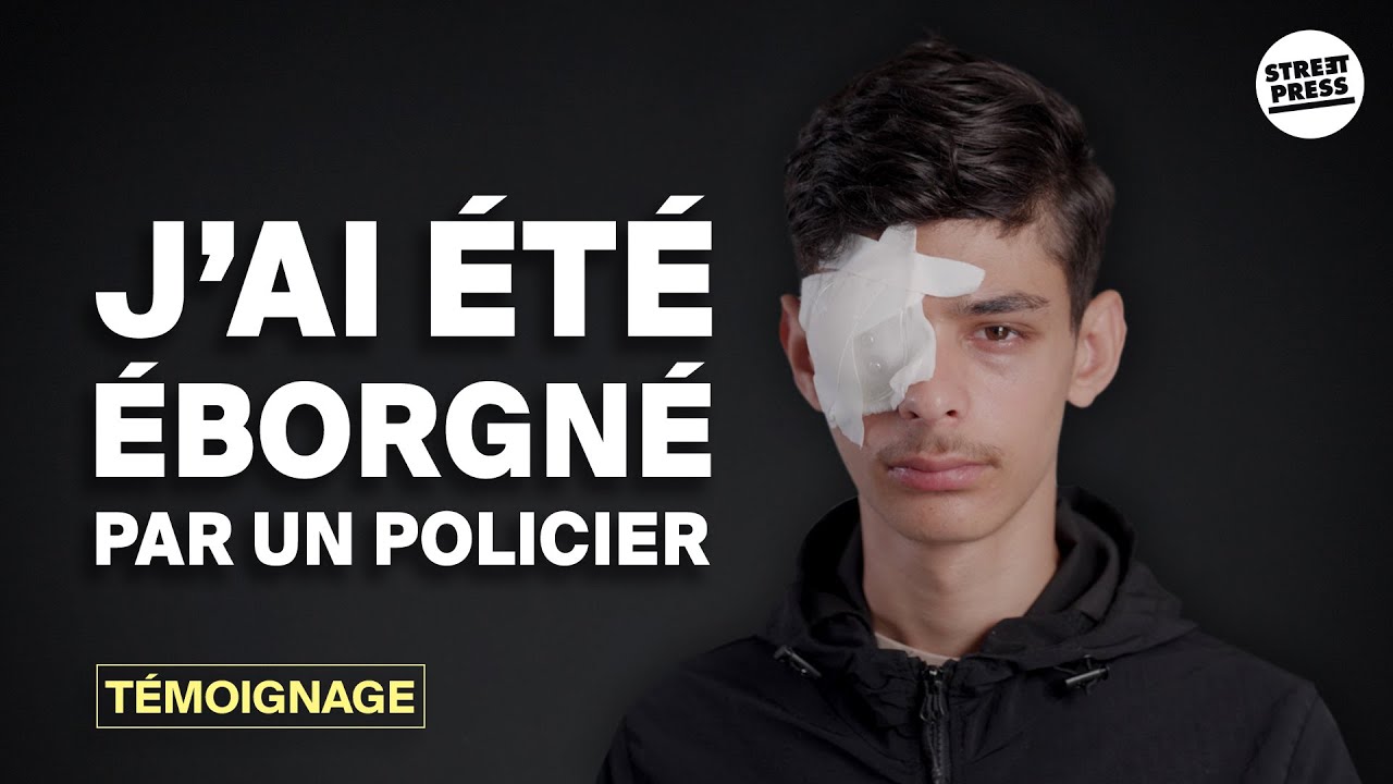 ⁣Jalil, 15 ans, éborgné par la police pendant les révoltes à  Chilly-Mazarin