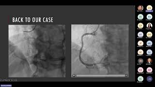 Recap of (some) ESC 2025 Trials with Zeeshan Ahmed, MD