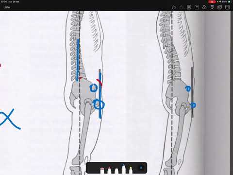 Vídeo: Com Mesurar La Pelvis