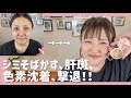 【カバーメイク】お悩みの方集合〜‼️ プロのカバー方法教えまーす😉