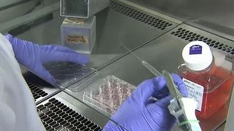 New test may help detect Alzheimer's earlier