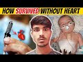 आखिर कैसे जिंदा थी बिना दिल के | HOW THIS GIRL SURVIVED WITHOUT HEART 😱 | random facts @factaxe