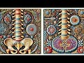 Lumbar Pain Patterns: Stenosis Versus Herniated Disc