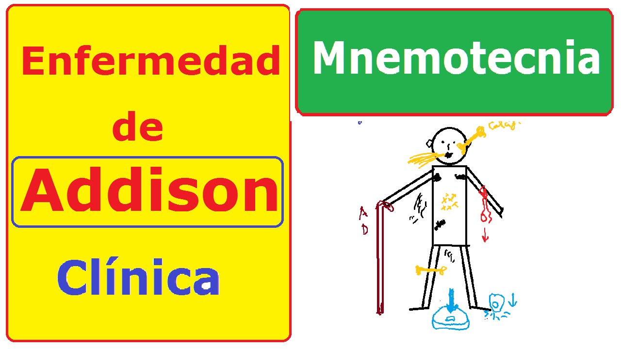 Enfermedad de Addison: memoriza la clínica | Mnemotecnia Enfermedad de Addison: memoriza la clínica | Mnemotecnia