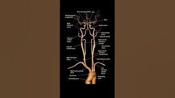 CT Angiography of Head and Neck Anatomy #angiography #neckangio #ctscan #radiology #angiography