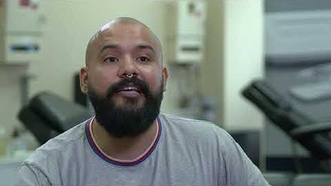 Scalp Micropigmentation Testimony