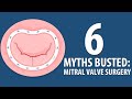 6 mitral valve surgery myths busted