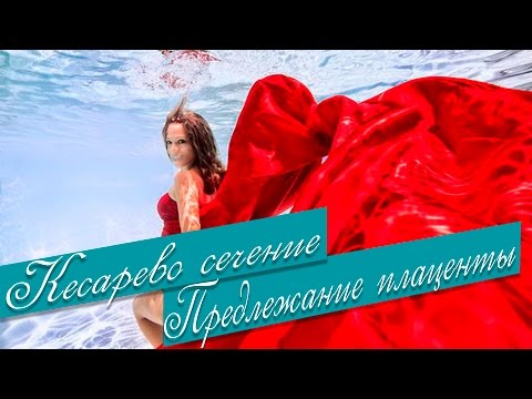 Сложные роды. Кесарево сечение. Предлежание плаценты. Плохой анализ.