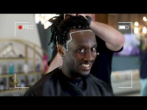 Hair Transplant Journey!