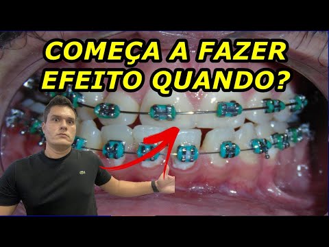 Vídeo: Quanto tempo leva para se ajustar ao movimento?