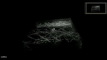 Flying into the centrosome