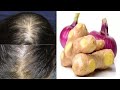 Onion &amp; Ginger Secret Overnight Double Hair Growth | Grow Long Hair Naturally | Extreme Hair Growth