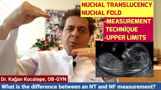 NT (nuchal Translucency) And NF (nuchal Fold) U/S Measurements. The Difference And Upper Limits. NT (nuchal Translucency) And NF (nuchal Fold) U/S Measurements. The Difference And Upper Limits.