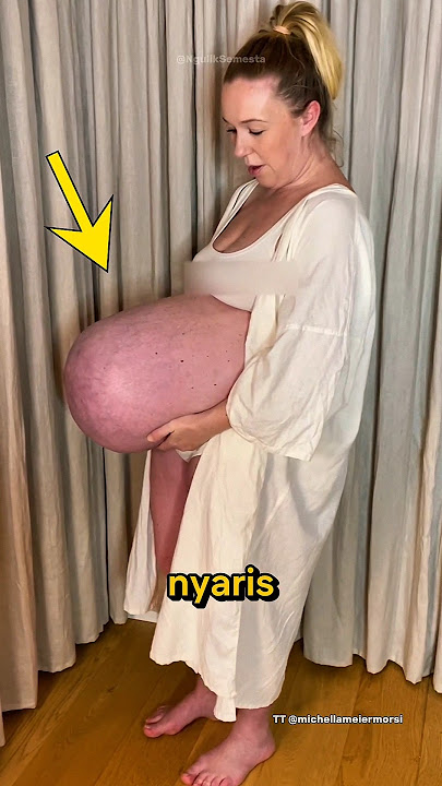 Giving Birth to Triplets