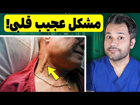 علت افت فشار عجیب این بیمار چی بود کاملا واقعی