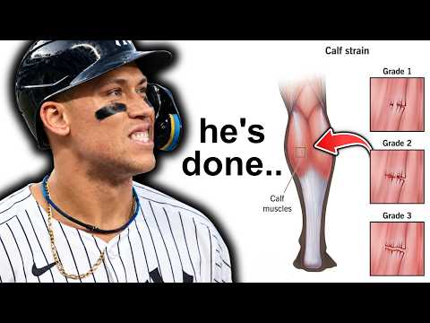 BREAKING: Aaron Judge Can’t Play Baseball Anymore..