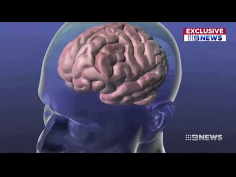 Channel 9 News interviews HRI about a scientific breakthrough for stroke
