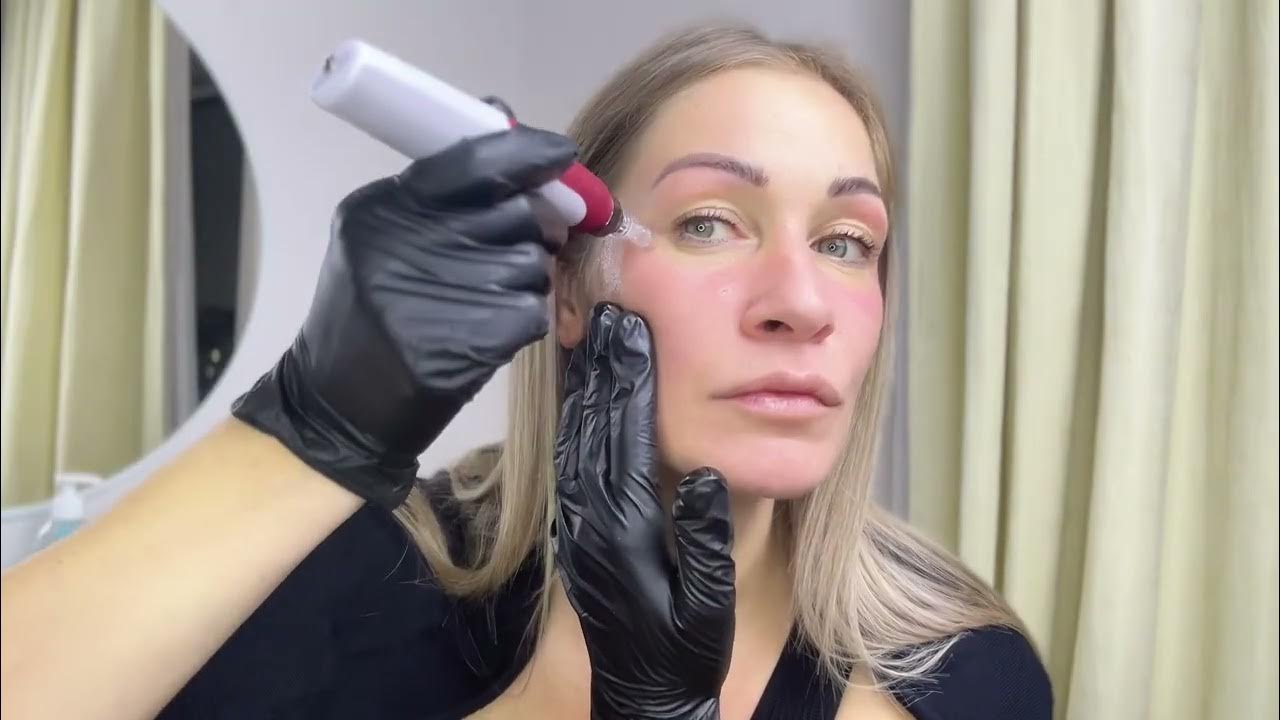 Фракционный аппарат Дермапен Dr pen N2 ⚡ Обзор топового электро ...