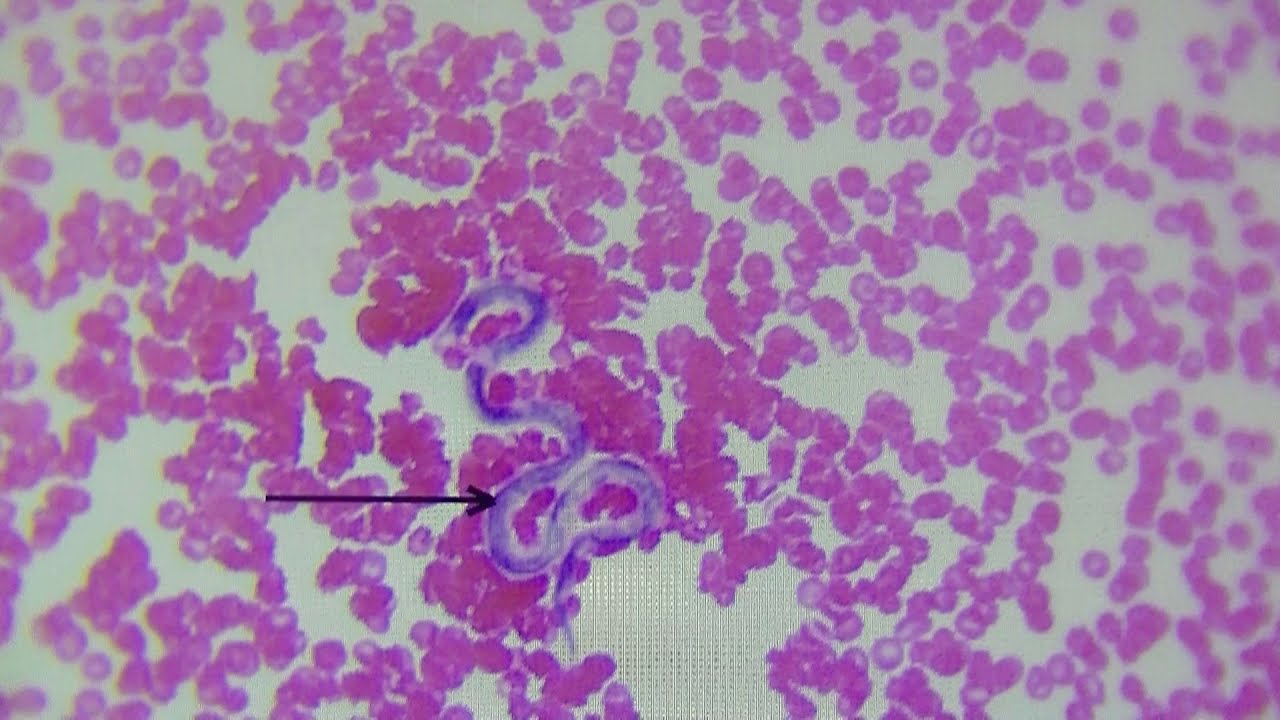 Blood smear annotated