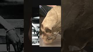Skull Binding: Reshaping Identity Through the Ages #history #creepy #facts #morbid #weird #ancient