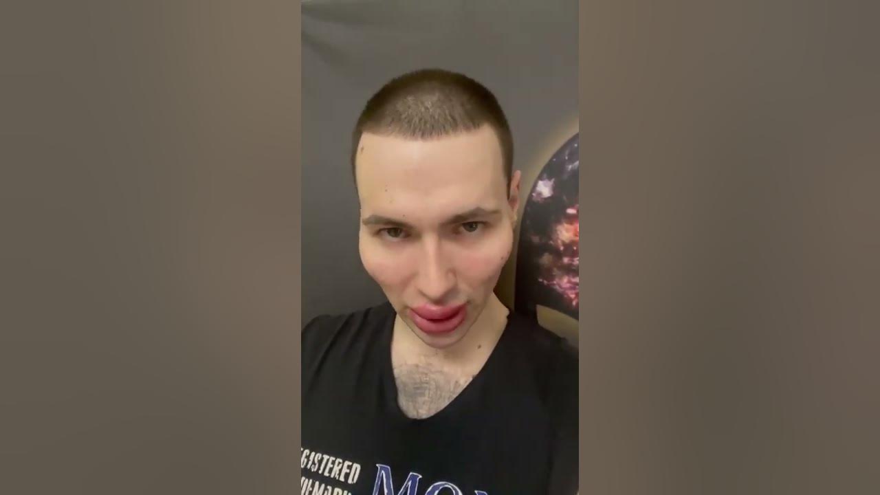 Евгений Ромашов накачал скулы