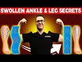Lymphedema Treatment [How to Get Rid of Swollen Feet, Ankles & Legs]