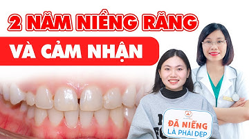 Sau 2 Năm Niềng Răng Thưa, Đây Là Cảm Nhận Khi Tháo Niềng | Bác sĩ Thu Gia Lâm