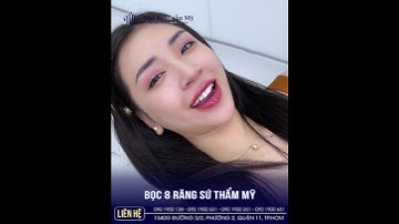 Tự tin tỏa sáng với nụ cười mới #rangsuthammy #nhakhoaaumy #nhakhoauytin #bocrangsu #rangsu